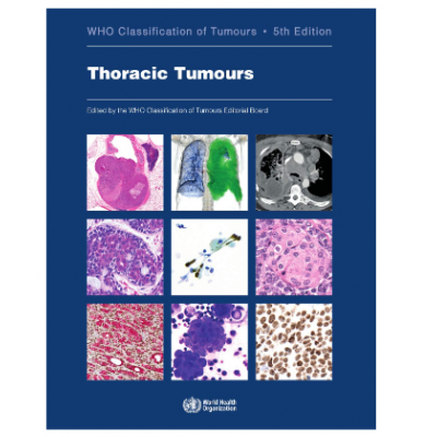 洋書 Breast Tumours , WHO 5th edition The WHO Classification oF Tomours - 5th Edition Breast Tumours | eBay
